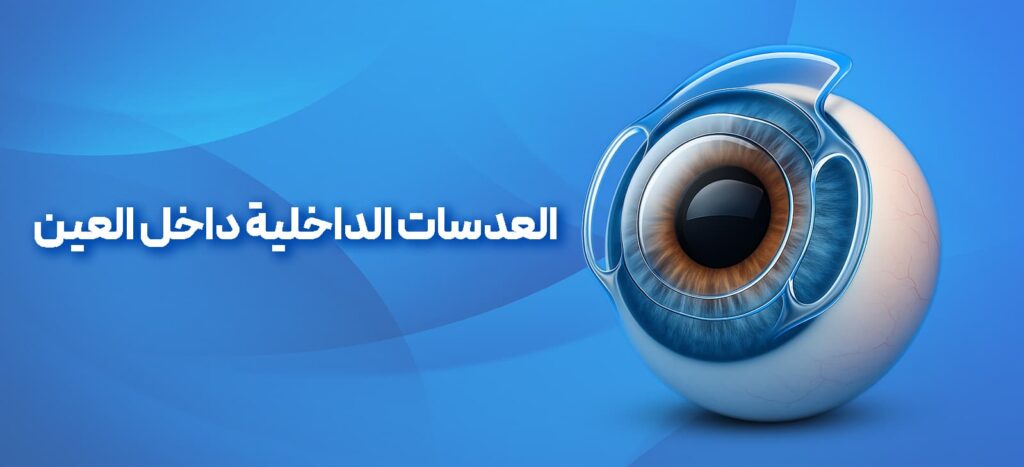 العدسات داخل العين