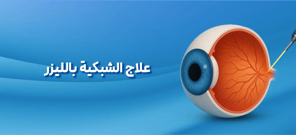 اللیزر الشبکیة
