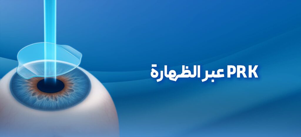 جراحة TransPRK