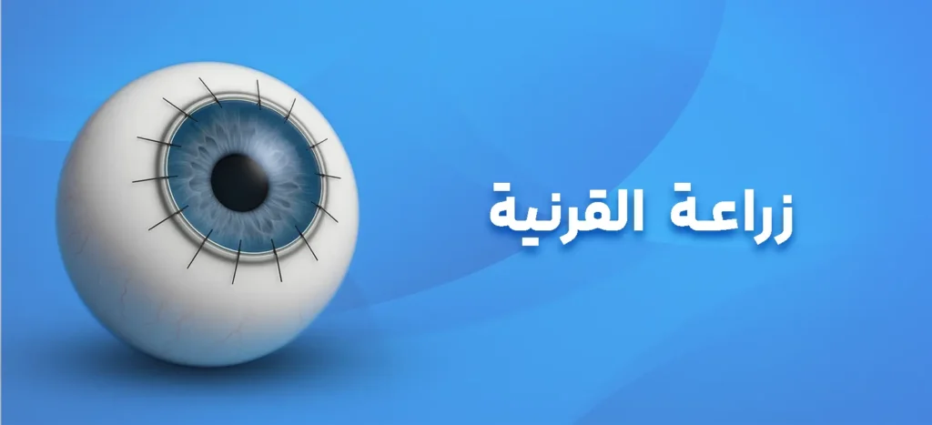 زراعة القرنية