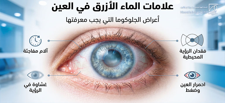 علامات الماء الازرق في العين