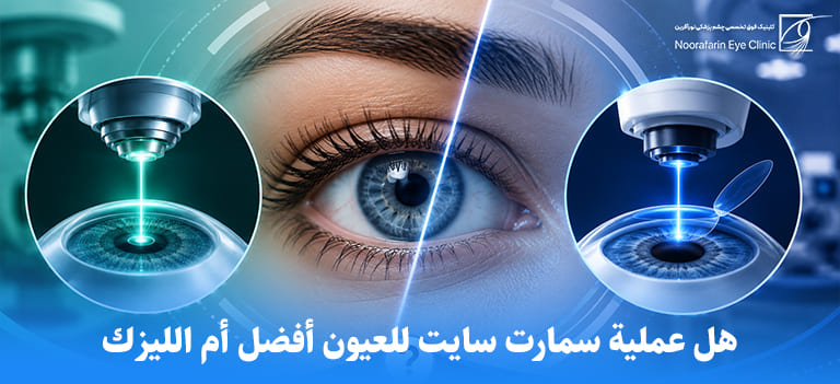 هل عملية سمارت سايت للعيون أفضل أم الليزك