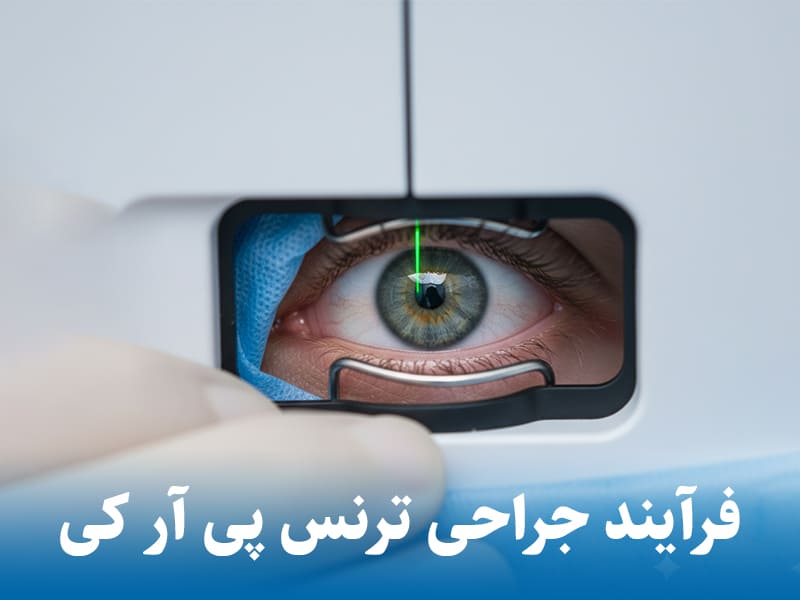 مراحل جراحی ترانس پی آر کی