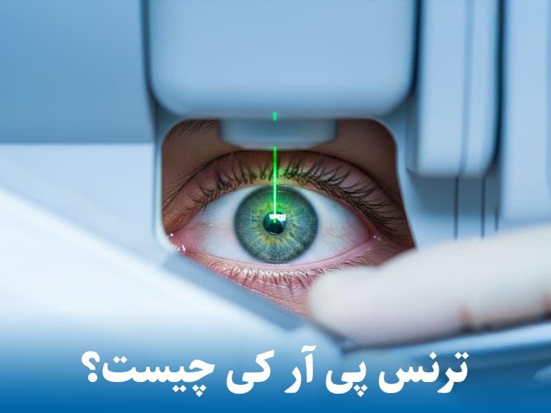 عمل ترنس پی آر کی چیست؟