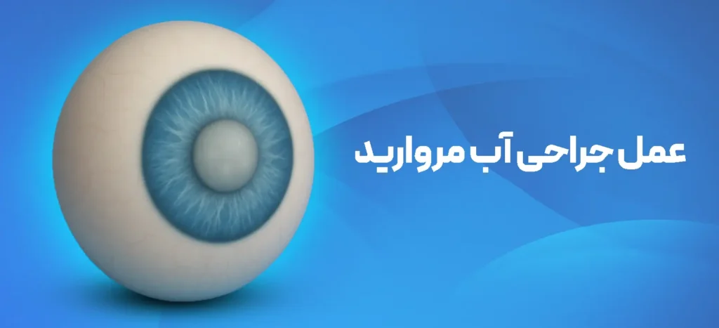 تمام آنچه که در رابطه با عمل جراحی آب مروارید