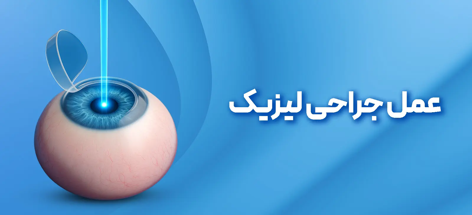 عمل لیزیک چشم