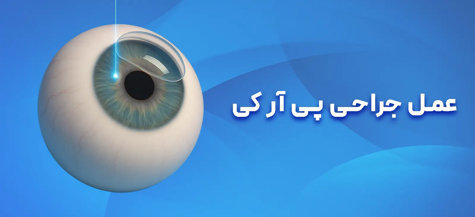 عمل جراحی پی آر کی