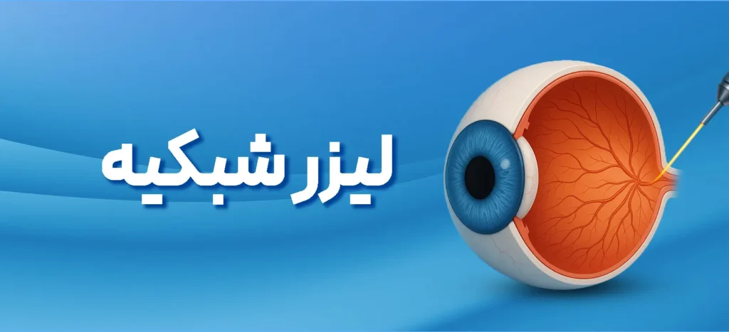 کلینیک تخصصی لیزر شبکیه