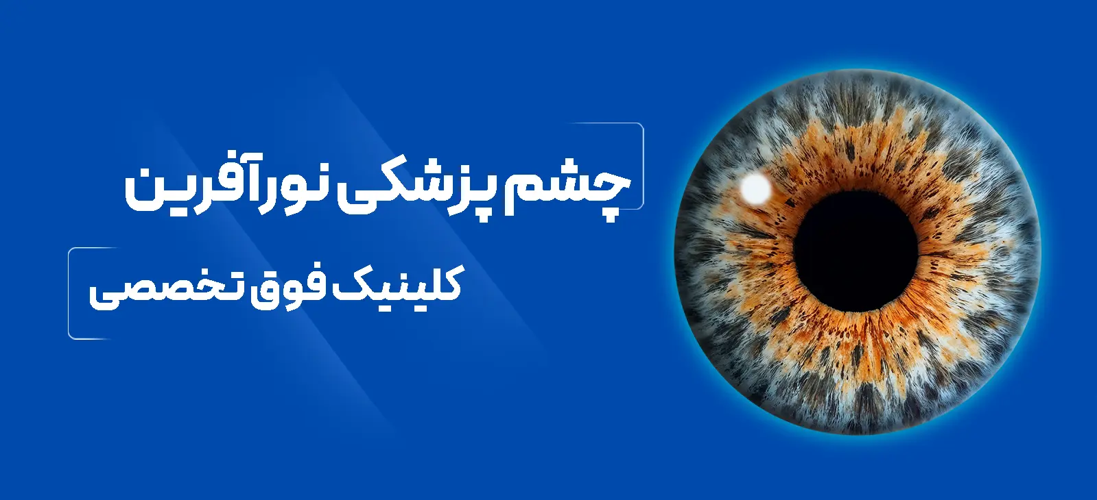کلینیک فوق تخصصی چشم نور آفرین