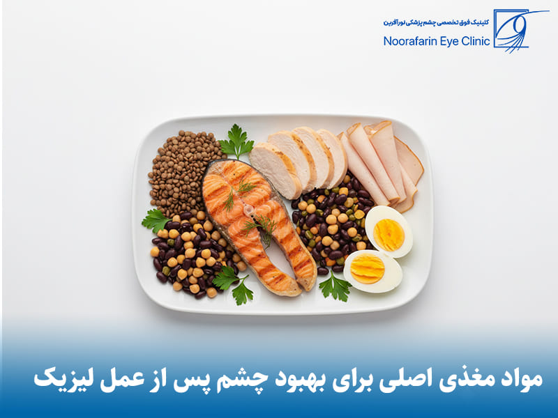 موادغذایی مناسب برای تقویت چشم بعد از عمل لیزیک