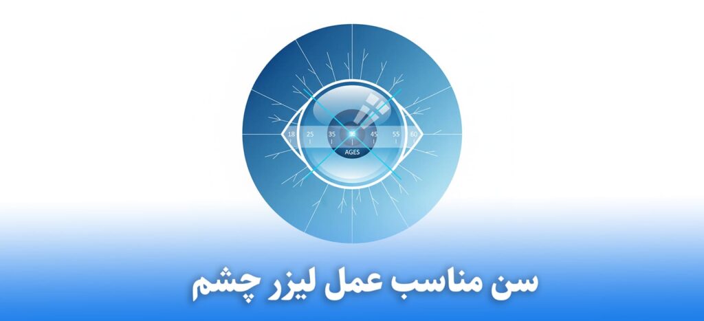 سن مناسب عمل لیزر چشم