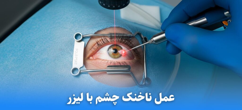 عمل ناخنک چشم با لیزر