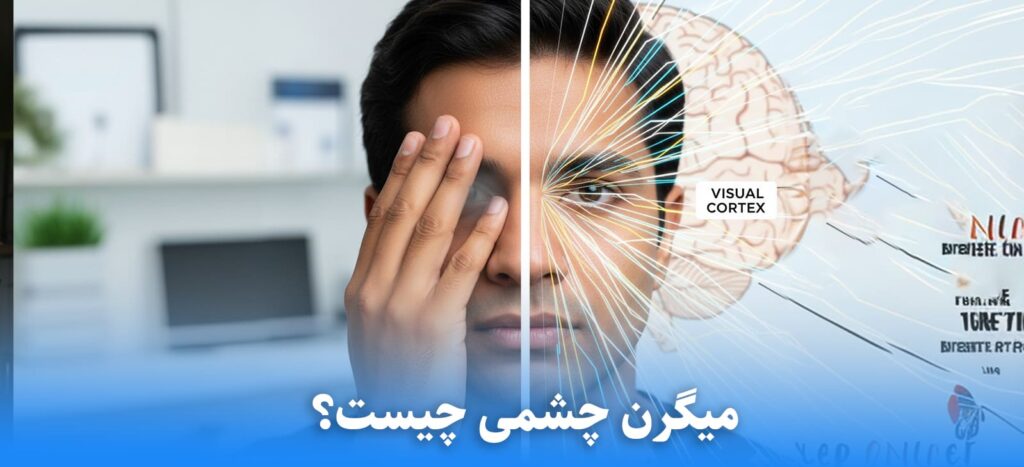 میگرن چشمی چیست؟