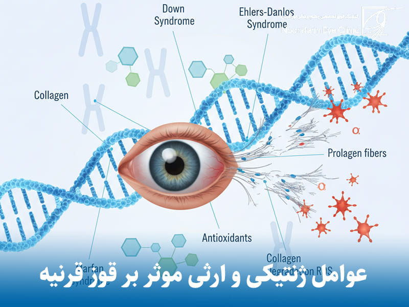عوامل ژنتیکی، ارثی و سیستمیک موثر بر قوز قرنیه