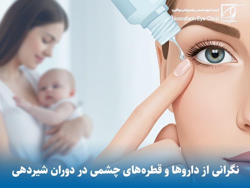 نگرانی‌های دارویی: آیا قطره‌های چشم وارد شیر می‌شوند؟