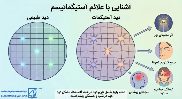 علائم و نشانه‌های آستیگماتیسم