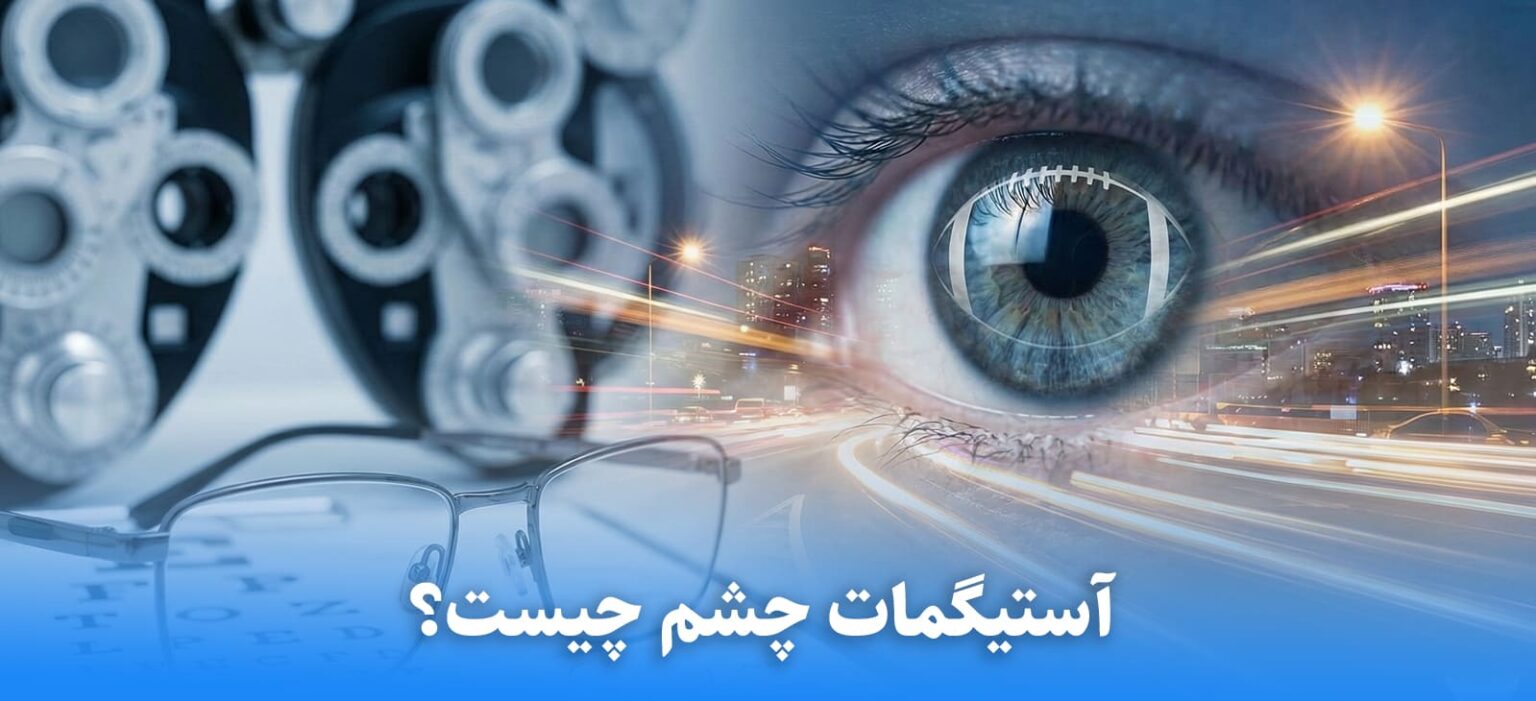 آستیگمات چشم چیست؟ راهنمای جامع علائم، درمان و حقایق علمی