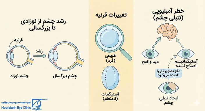آیا آستیگمات از کودکی تا بزرگسالی تغییر می‌کند؟