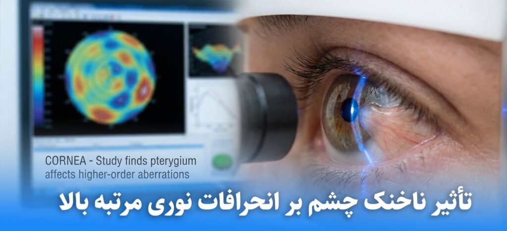 تأثیر ناخنک چشم (Pterygium) بر انحرافات نوری مرتبه بالا