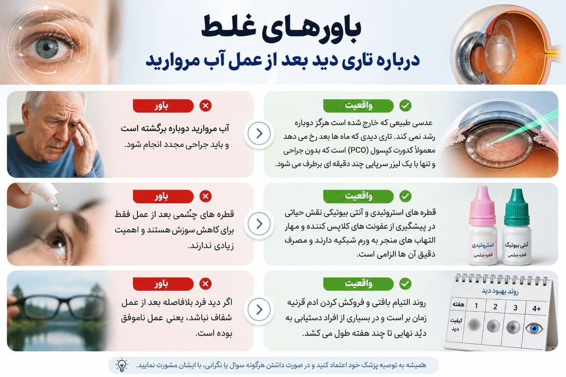 باورهای غلط درباره تاری دید بعد از عمل آب مروارید
