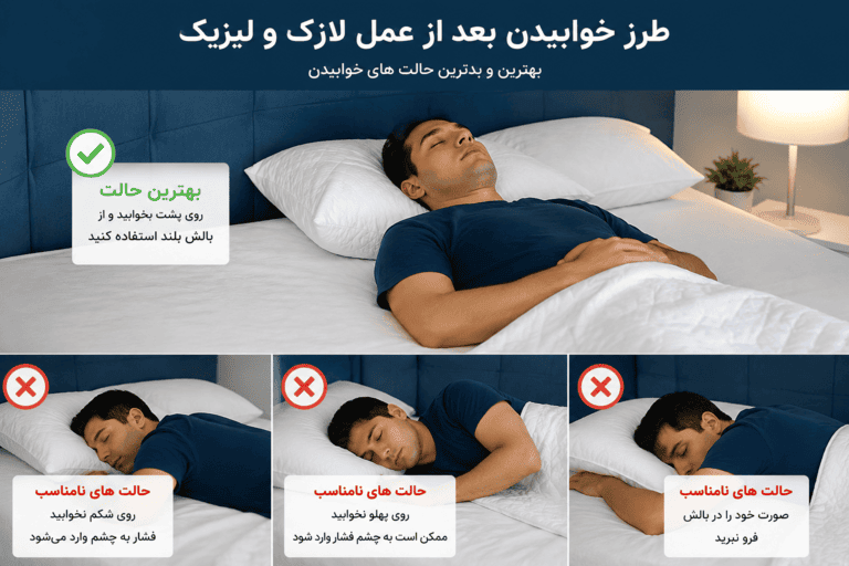 چرا نحوه خوابیدن بعد از عمل لیزیک چشم اهمیت حیاتی دارد؟