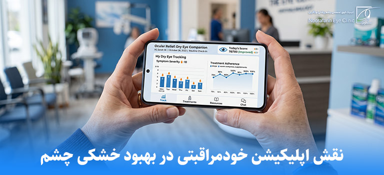 نقش اپلیکیشن خودمراقبتی در بهبود خشکی چشم