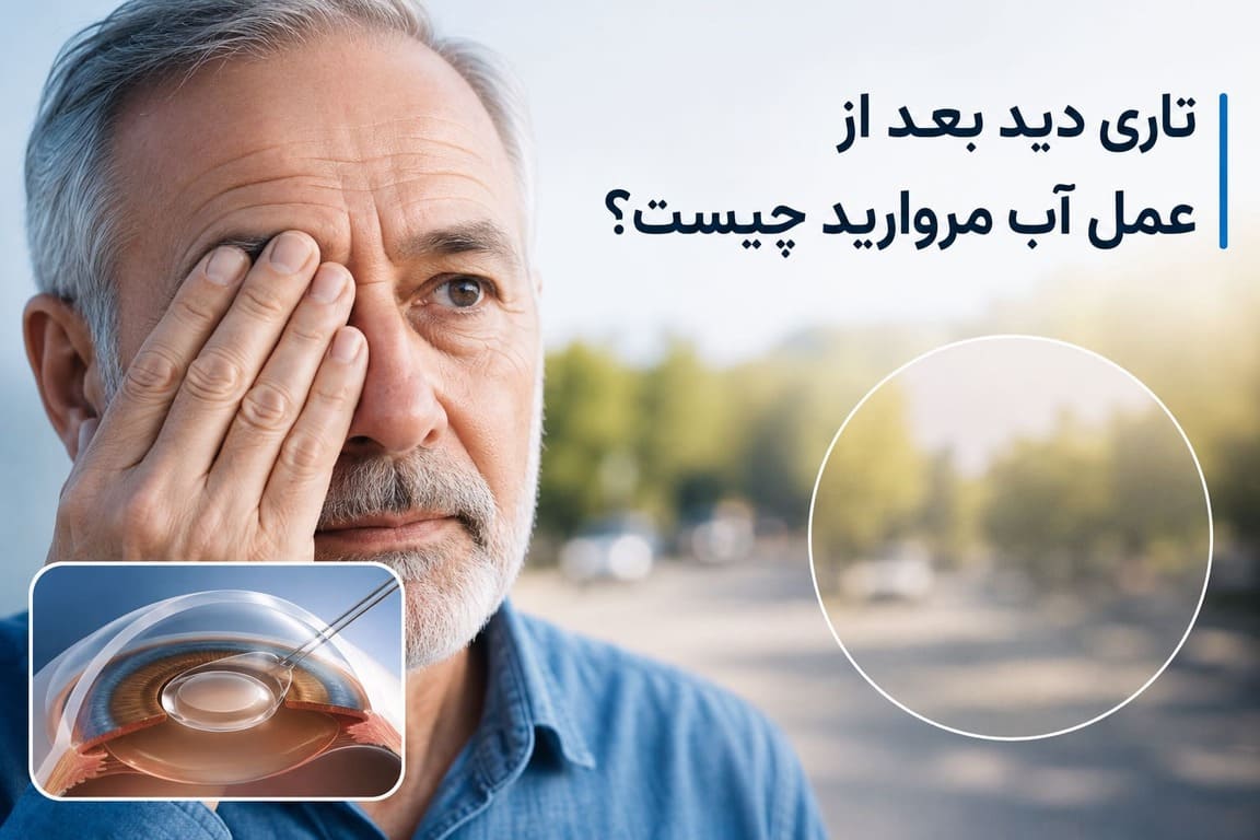 تاری دید بعد از عمل آب مروارید چیست
