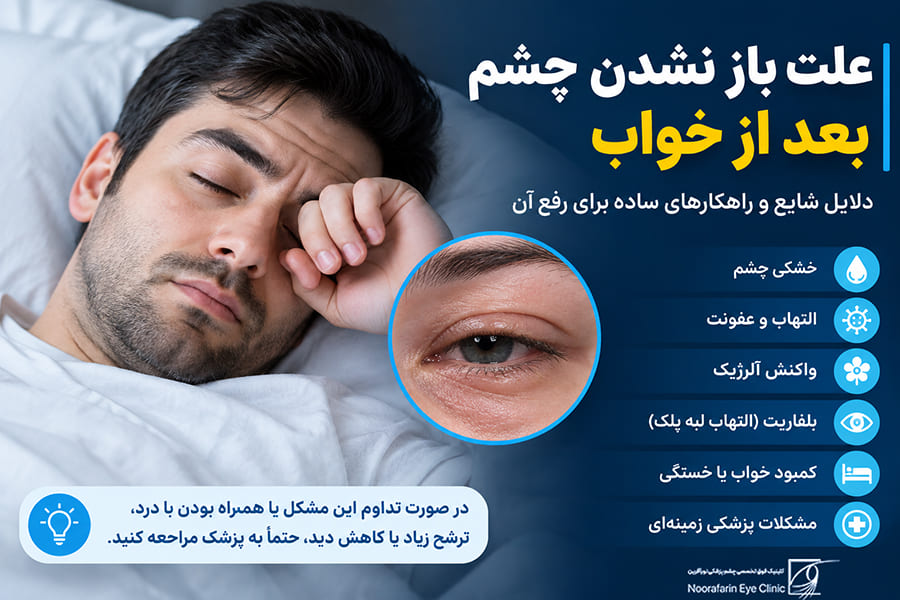 علت باز نشدن چشم بعد از خواب