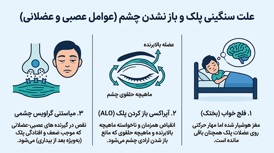 علت درد شدید چشم اول صبح ناشی از آسیب های قرنیه و پلک