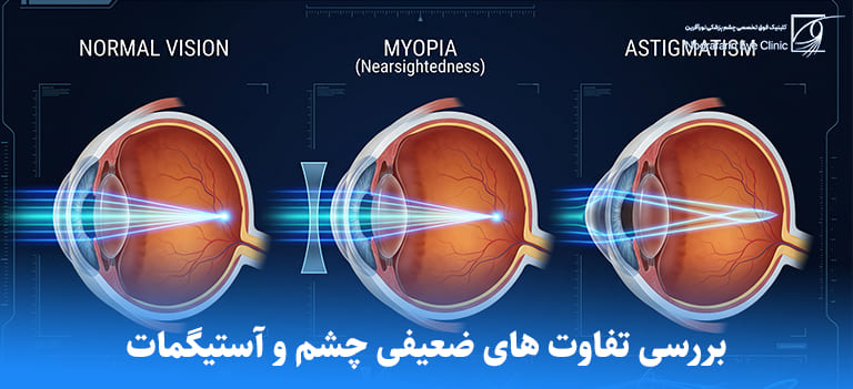 بررسی تفاوت های ضعیفی چشم و آستیگمات