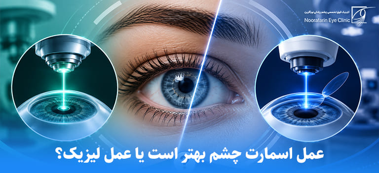 smartsight vs lasik eye surgery whats the difference