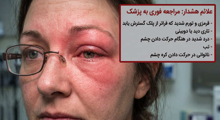 علائم هشدار: چه زمانی باید فوراً به چشم‌پزشک مراجعه کرد؟